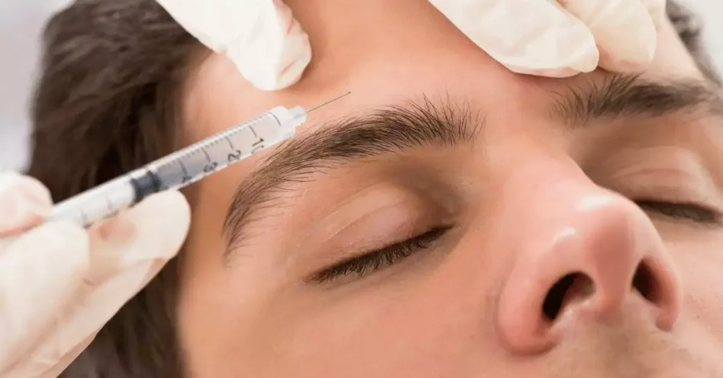 Botox for Migraine | American Migraine Foundation