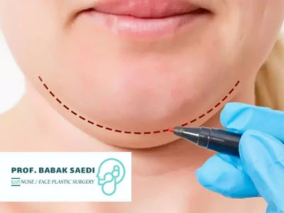 هفته اول بعد از لیپوساکشن